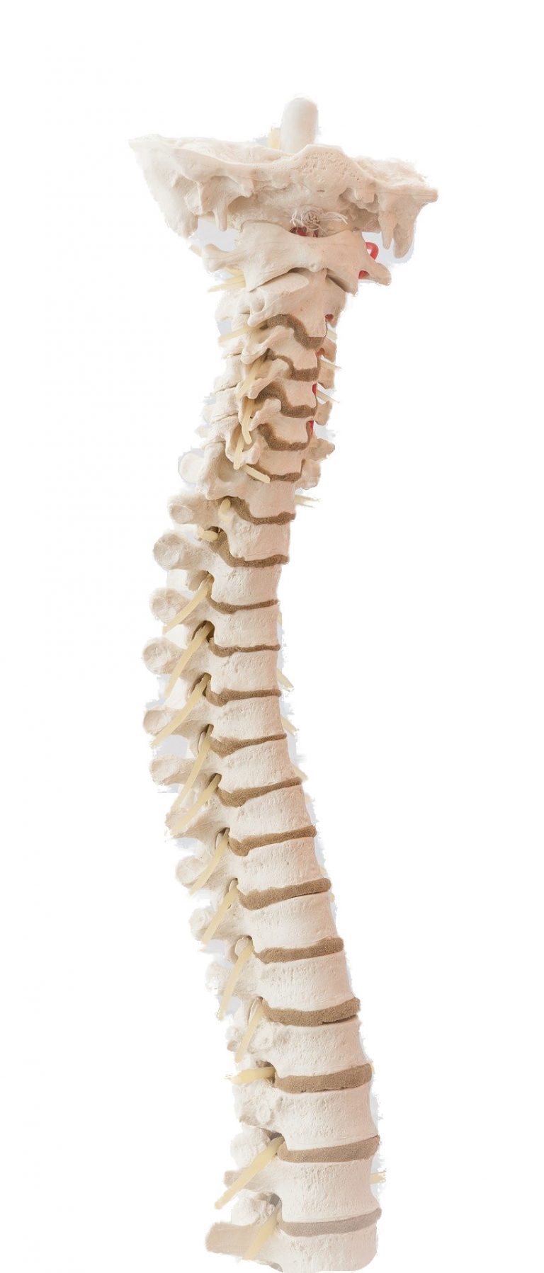 Rückenschmerzen ursachen